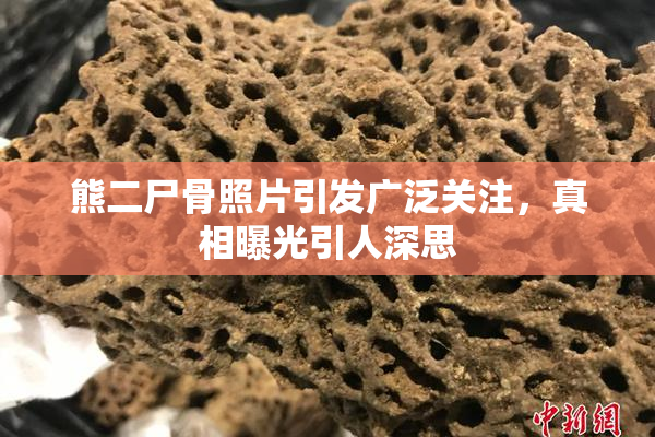 熊二尸骨照片引发广泛关注，真相曝光引人深思