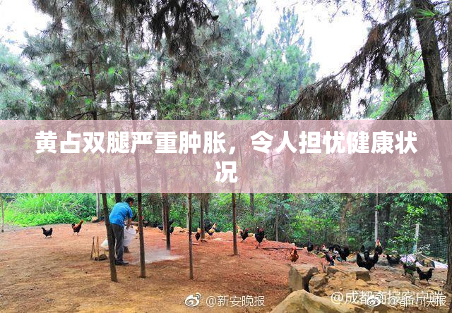 黄占双腿严重肿胀，令人担忧健康状况