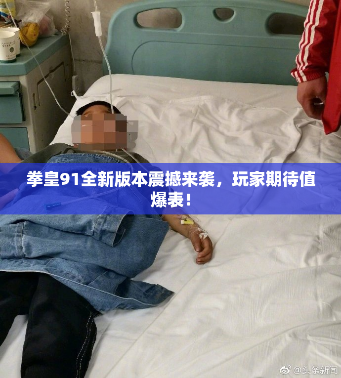 拳皇91全新版本震撼来袭，玩家期待值爆表！