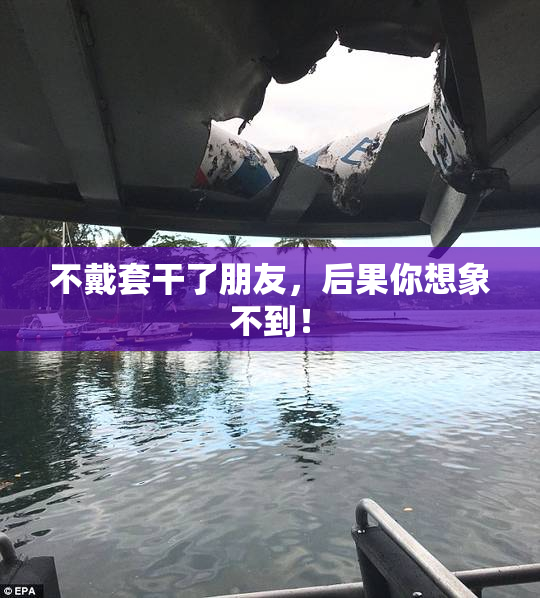 不戴套干了朋友，后果你想象不到！