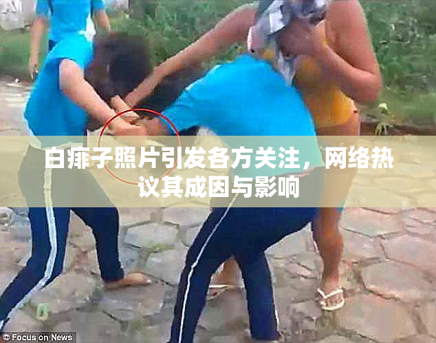 白痱子照片引发各方关注，网络热议其成因与影响