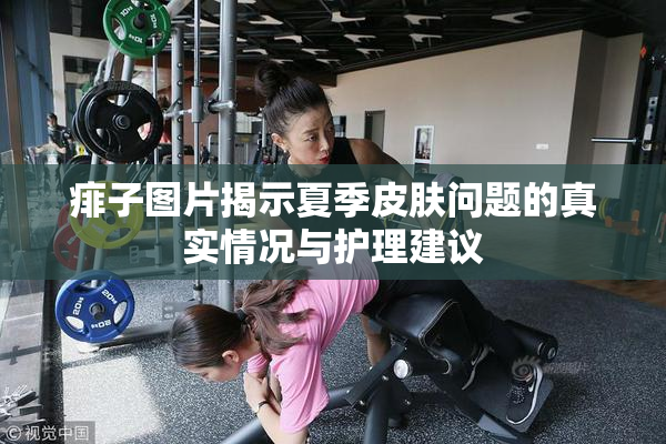 痱子图片揭示夏季皮肤问题的真实情况与护理建议