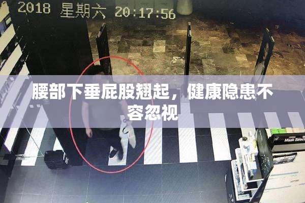腰部下垂屁股翘起，健康隐患不容忽视