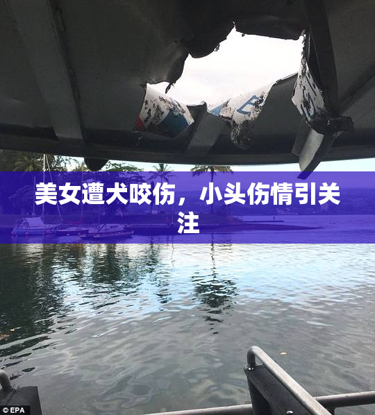 美女遭犬咬伤，小头伤情引关注