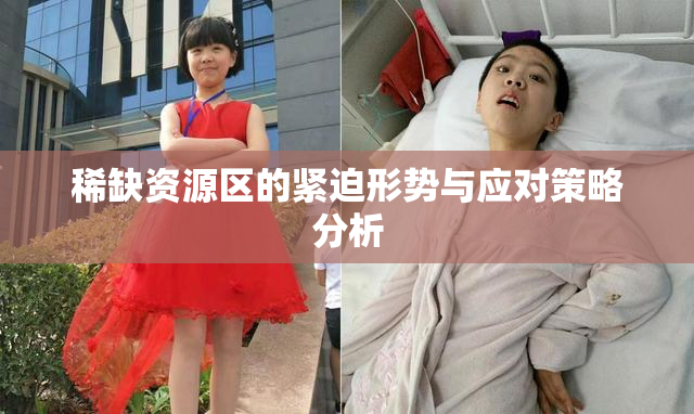 稀缺资源区的紧迫形势与应对策略分析