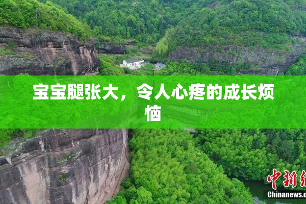 宝宝腿张大，令人心疼的成长烦恼