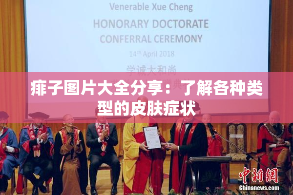 痱子图片大全分享：了解各种类型的皮肤症状